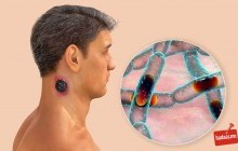Увс аймгийн Тэс суманд боом өвчнөөр хоёр иргэн өвчилжээ